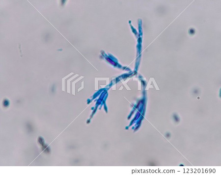 Conidia of Penicillium that spread like flowers Conidia of Penicillium that spread like flowers 123201690