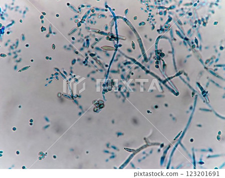 Cotton blue staining of imperfect fungi Cotton blue staining of imperfect fungi 123201691