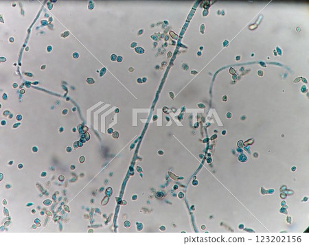 Long, straight mold hyphae Long, straight mold hyphae 123202156