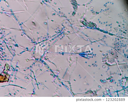 Penicillium spores with a brush-like shape Penicillium spores with a brush-like shape 123202889