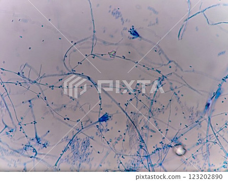 Mold separated from the outside of the refrigerator Mold separated from the outside of the refrigerator 123202890