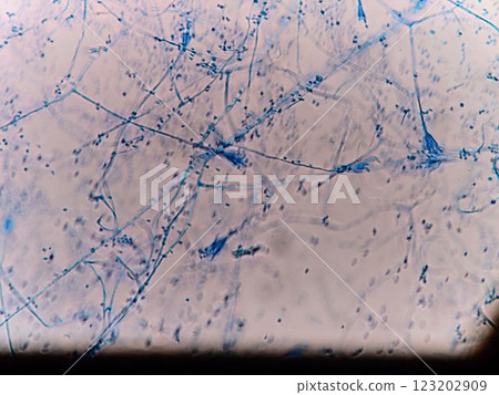 Conidia visible among hyphae 123202909