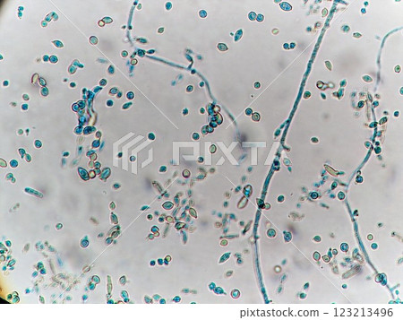 Mold growing everywhere 123213496