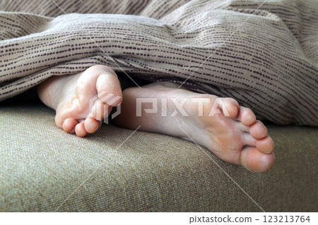 Dry cracked skin of woman feet in bed. Foot treatment. Dry cracked skin of woman feet in bed. Foot treatment. 123213764