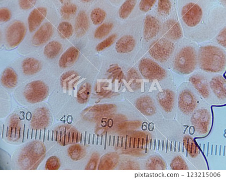 Chromosomes being pulled towards both poles Chromosomes being pulled towards both poles 123215006