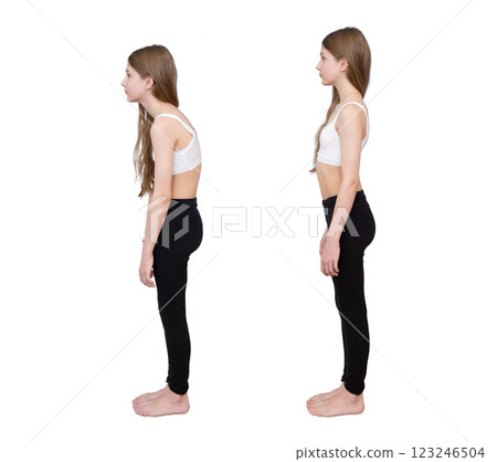 Good posture and bad posture girl, side view. Problems of slouching, curvature of the spine Good posture and bad posture girl, side view. Problems of slouching, curvature of the spine 123246504