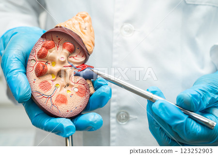 Kidney disease, Chronic kidney disease ckd, Doctor hold human model to treat and study in hospital. 123252903