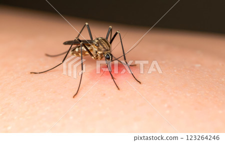 Mosquito biting human skin, disease carrier insect, malaria, dengue, Zika virus, health risk, bloodsucking pest, diseases, itchy bite, close-up photo 123264246