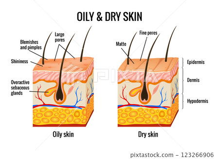Oily and dry skin anatomy. Human body skin vector illustration with parts vein artery hair sweat gland epidermis dermis and hypodermis. Human Cross-section of the skin layers structure Oily and dry skin anatomy. Human body skin vector illustration with parts vein artery hair sweat gland epidermis dermis and hypodermis. Human Cross-section of the skin layers structure 123266906