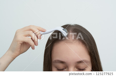 Young brunette woman using microneedling derma roller on scalp stimulating new hair growth with copy space for text. Alopecia treatment, scalp stimulation, hair loss and baldness targeted therapy. 123277925
