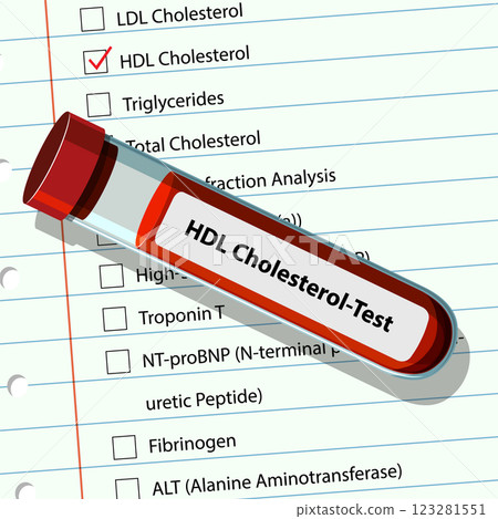 HDL Cholesterol Test Illustration HDL Cholesterol Test Illustration 123281551