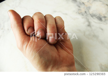 Left male hand with cuts and dirt close-up 123290383