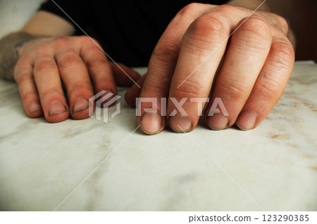 Male hands with broken nails close-up. Hand skin care Male hands with broken nails close-up. Hand skin care 123290385