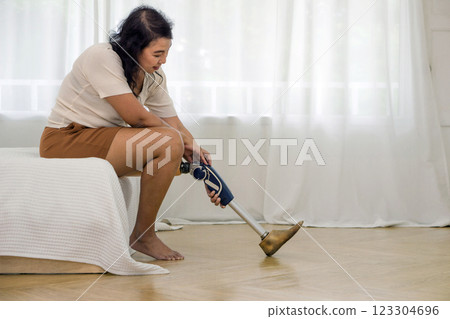 Asian woman disability with prosthetics bionic leg, prosthetic limbs sitting in bedroom at home. Asian woman disability with prosthetics bionic leg, prosthetic limbs sitting in bedroom at home. 123304696