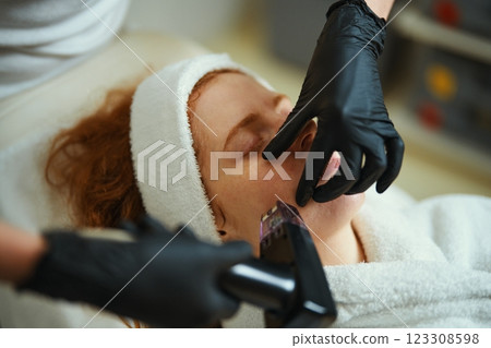 Skin treatment session at a spa with a focus on facial rejuvenation 123308598