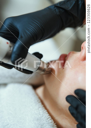 Skin treatment procedure using a microneedling device in a clinic setting 123308626
