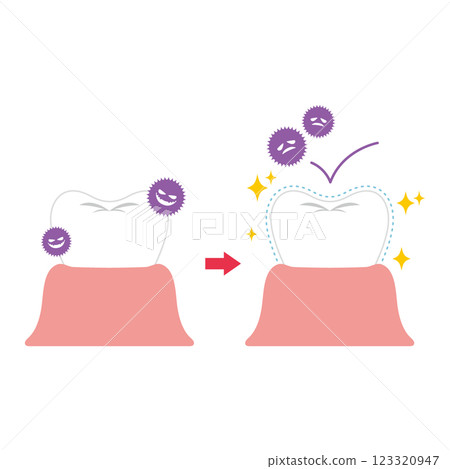 Illustration of teeth coated to prevent pigmentation and tooth decay 123320947
