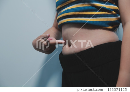 Women body fat belly. Obese woman hand holding excessive belly fat. diet lifestyle concept to reduce belly and shape up healthy stomach muscle. Women body fat belly. Obese woman hand holding excessive belly fat. diet lifestyle concept to reduce belly and shape up healthy stomach muscle. 123371125