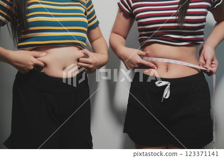 Women body fat belly. Obese woman hand holding excessive belly fat. diet lifestyle concept to reduce belly and shape up healthy stomach muscle. 123371141