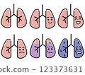 Illustration of the lungs 123373631