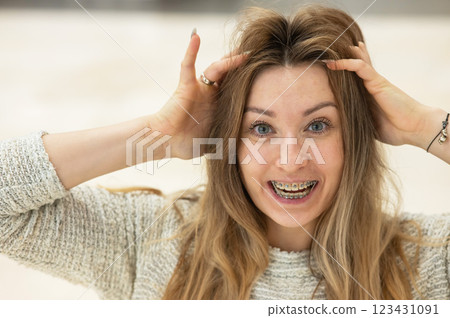 Portrait of a grimacing woman with braces on her teeth.  123431091