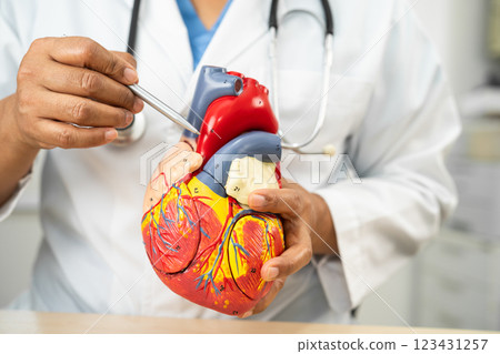 Cardiovascular disease CVD, Asian doctor holding human anatomy model for learn and treat heart disease. 123431257