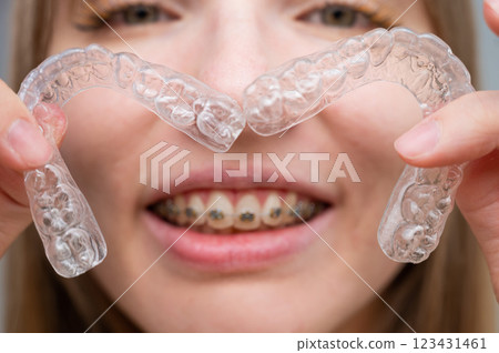 Woman with braces on her teeth holding and removable transparent aligners.  123431461