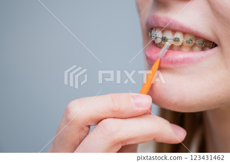 Unrecognizable Caucasian woman cleans braces with a brush. Close-up of female teeth with brackets 123431462
