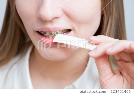 Young woman with metal braces on her teeth is chewing gum. Young woman with metal braces on her teeth is chewing gum. 123431465