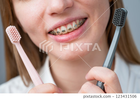 Cropped portrait of young smiling woman with braces holding two toothbrushes.  123431506
