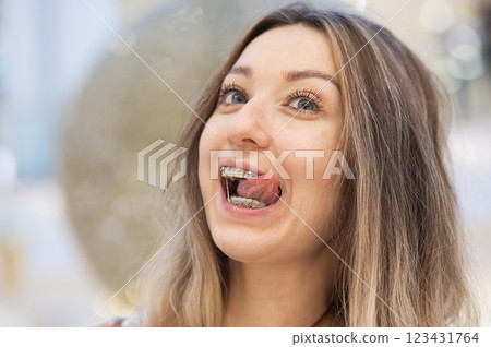 Portrait of a grimacing woman with braces on her teeth.  123431764