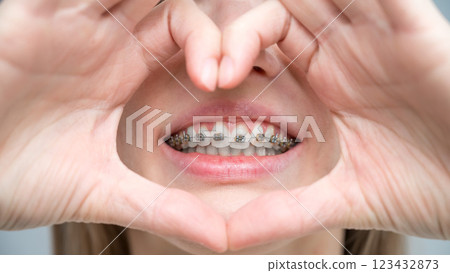 Caucasian woman in braces holding fingers in the shape of a heart.  123432873