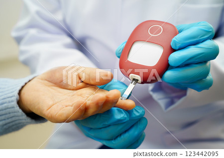Asian doctor using digital glucose meter for check sample blood sugar level to treatment diabetes. Asian doctor using digital glucose meter for check sample blood sugar level to treatment diabetes. 123442095