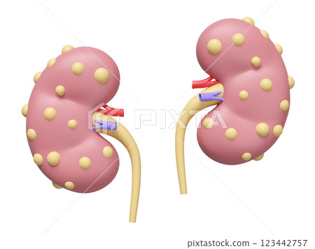 3d Chronic kidney disease or CKD isolated. world kidney day concept, 3d illustration render 123442757