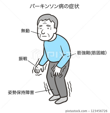 帕金森氏症的四大症狀2 123456726
