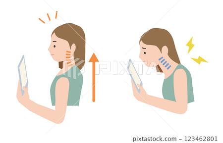 A woman looking at her smartphone with ideal posture and a woman with poor posture who suffers from straight neck and smartphone neck pain 123462801