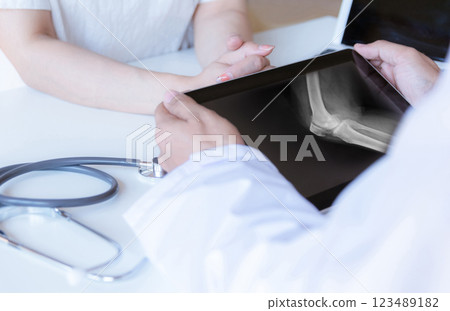 The doctor examines the patient and looks at the X-ray film of the knee. The doctor examines the patient and looks at the X-ray film of the knee. 123489182
