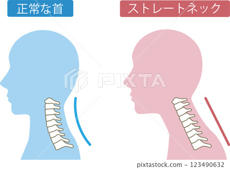 直頸前後 123490632
