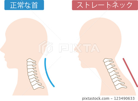 直頸前後 123490633