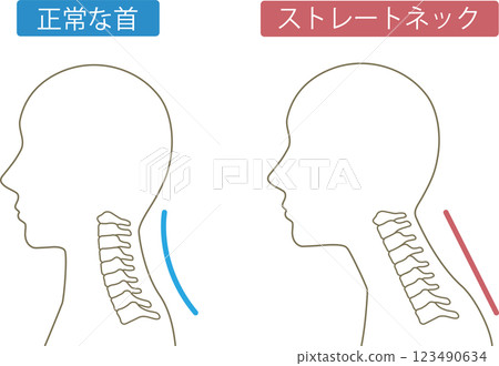 直頸前後 123490634