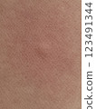 Skin, eczema, close-up 123491344