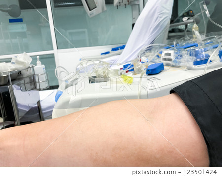 Blood platelet donation, a male nurse inserts a needle into donor arm to draw blood at a hospital. Blood platelet donation, a male nurse inserts a needle into donor arm to draw blood at a hospital. 123501424