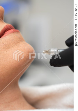 Skin treatment procedure with aesthetic injector in a clinical setting 123518525