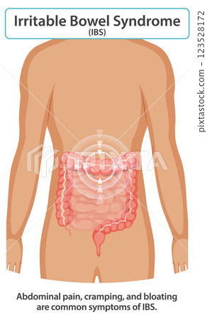 Understanding Irritable Bowel Syndrome Symptoms Understanding Irritable Bowel Syndrome Symptoms 123528172