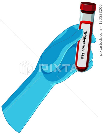 Medical Blood Test Illustration 123528206