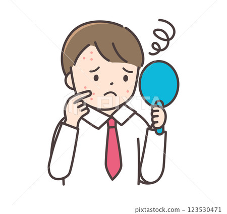 A male junior high school student in uniform who is concerned about rough skin 123530471