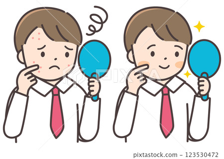 Before and after illustration of a male junior high school student suffering from acne Before and after illustration of a male junior high school student suffering from acne 123530472