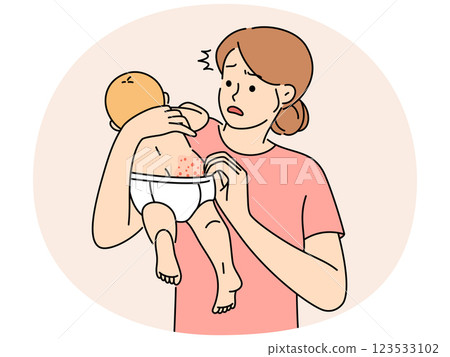 Anxious young mother confused with baby body rash Anxious young mother confused with baby body rash 123533102
