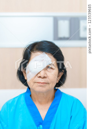 Elderly Woman with eye protective shield after eye surgery. Eye disease, Cataract,  Glaucoma, Age Related Macular Degeneration, Diabetic Retinopathy, Vitreous, Lasik, World Glaucoma day and health 123539685