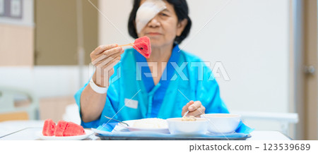Senior Woman eating food after eye surgery in hospital . Eye disease, Cataract, Glaucoma, Age Related Macular Degeneration, Diabetic Retinopathy, Lasik, World Glaucoma day and health treatment Senior Woman eating food after eye surgery in hospital . Eye disease, Cataract, Glaucoma, Age Related Macular Degeneration, Diabetic Retinopathy, Lasik, World Glaucoma day and health treatment 123539689